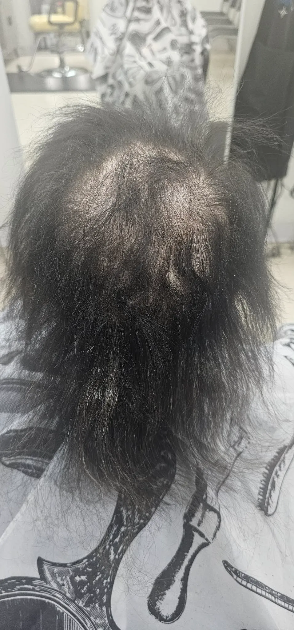 Antes: cabello escaso visto desde arriba